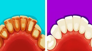 13 EFFECTIVE LIFE HACKS FOR YOUR TEETH